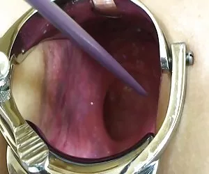 Sperma compilazione Sabina